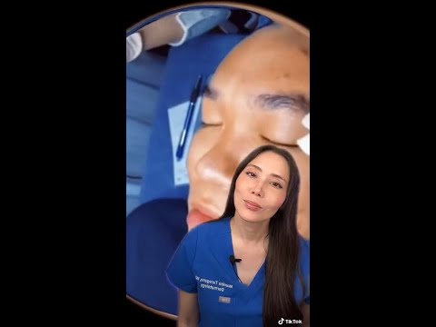 Blackhead removal